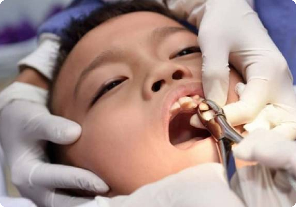 gigi bertindih pasang braces
