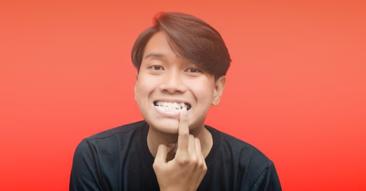 gigi bertindih pasang braces