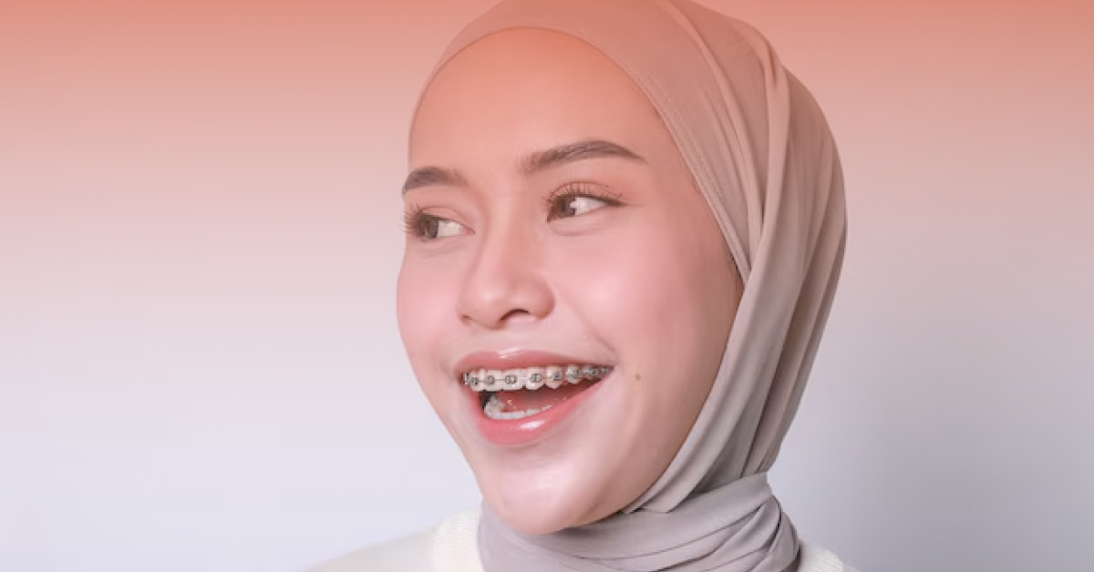 braces murah di kajang