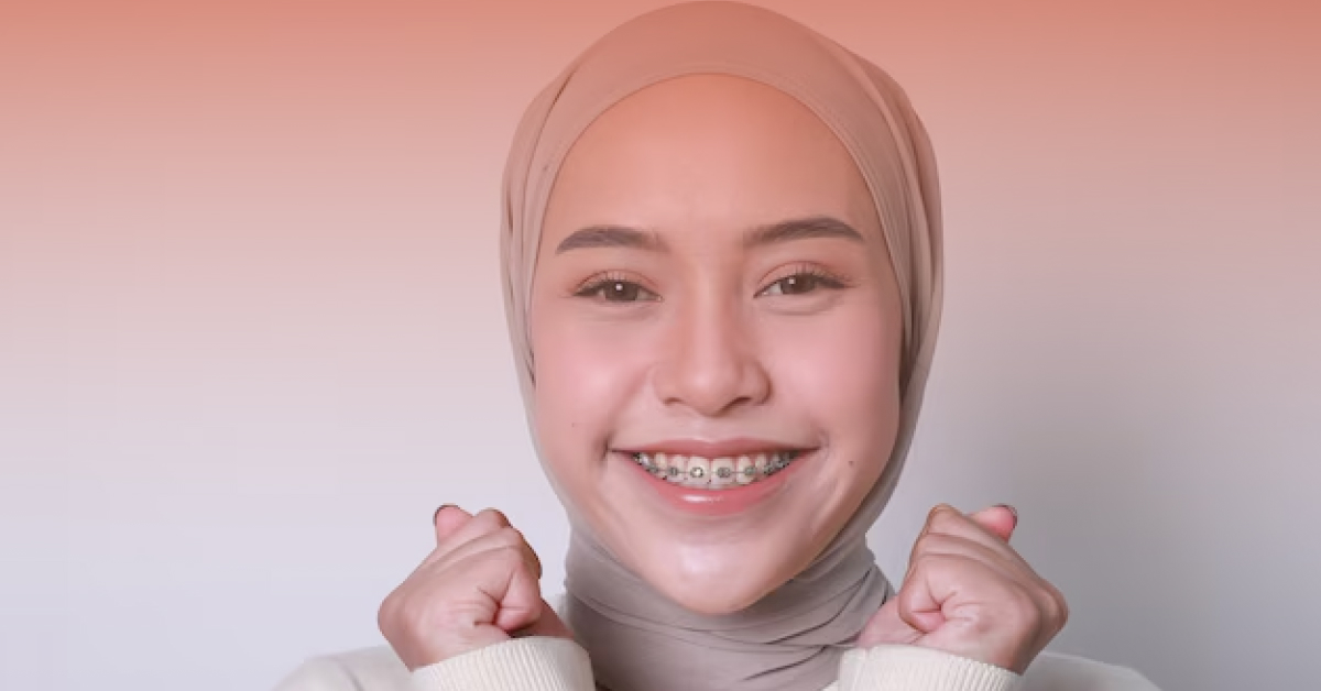 braces warna warni untuk pelajar sekolah-1