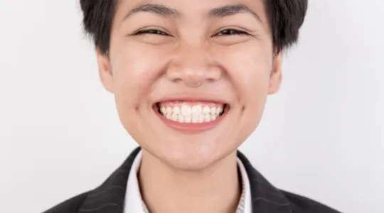 estetik gigi yakin senyuman