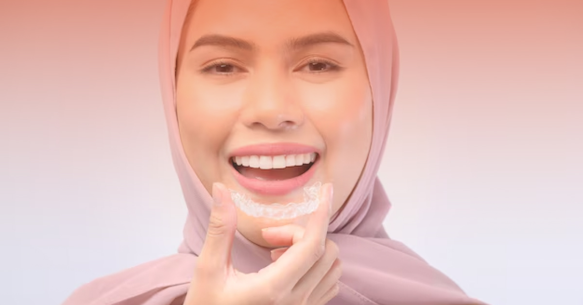 perbezaan aligner dan braces