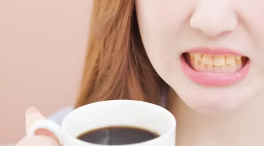 gigi kuning kesan minum kopi