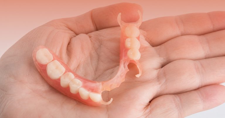 Anggaran Harga Gigi Palsu Sebatang di Aesira Dental (2026)