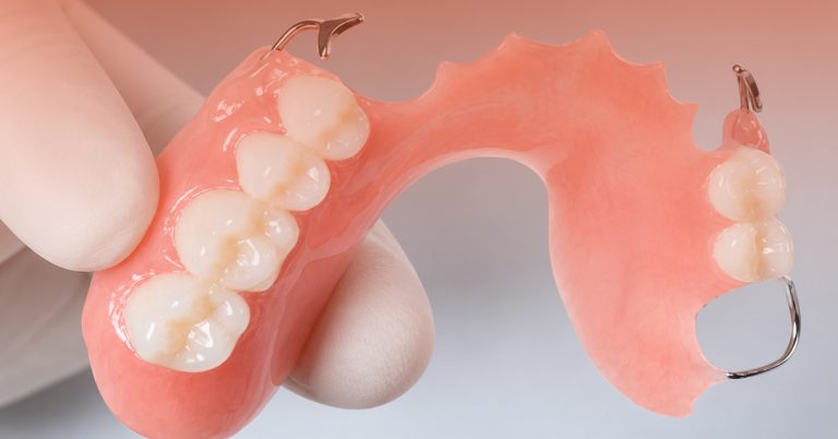 5 Jenis Gigi Palsu dan Rawatan Beserta Harga (Aesira Dental)