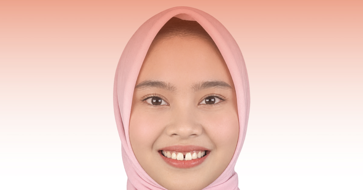 gigi jarang diastema