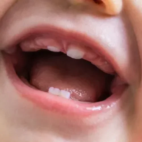 gigi bayi klinik pergigian kajang bangi aesira dental (1) (1)